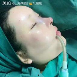 肋骨鼻视频,美容新趋势的诞生与影响